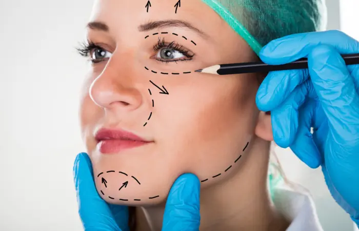 Cirurgias de Facelift