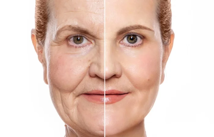 O que realmente te envelhece (e não é só a pele!) — Entenda os 4 fatores do envelhecimento facial