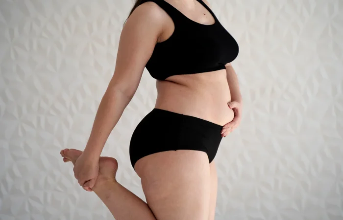 Diástase abdominal pós-gestação: quando o problema não é falta de esforço